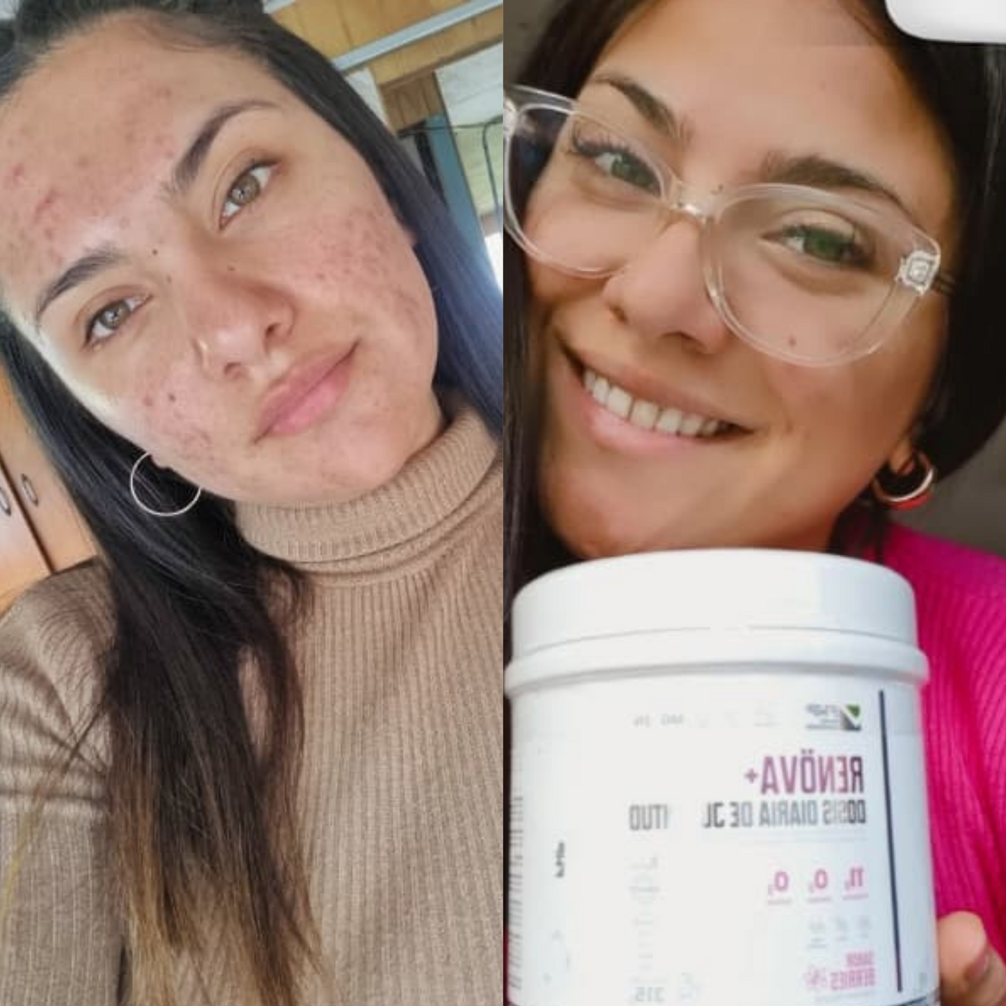 Renova+: Colágeno Doblemente Hidrolizado Premium para Piel y Articulaciones en Chile