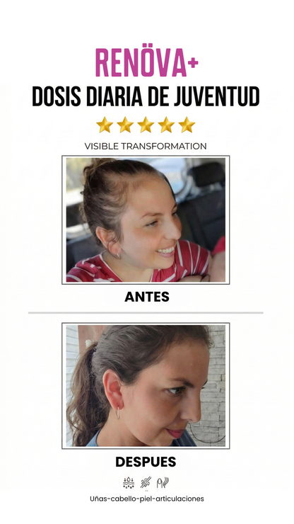 RENOVA+ V3.0: Colágeno Premium Potenciado con 7 Vitaminas Adicionales