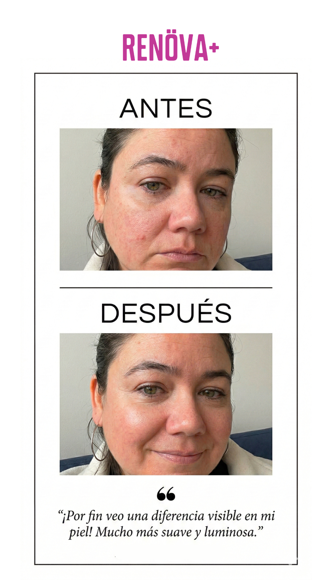 RENOVA+ V3.0: Colágeno Premium Potenciado con 7 Vitaminas Adicionales