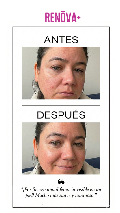 RENOVA+ V3.0: Colágeno Premium Potenciado con 7 Vitaminas Adicionales